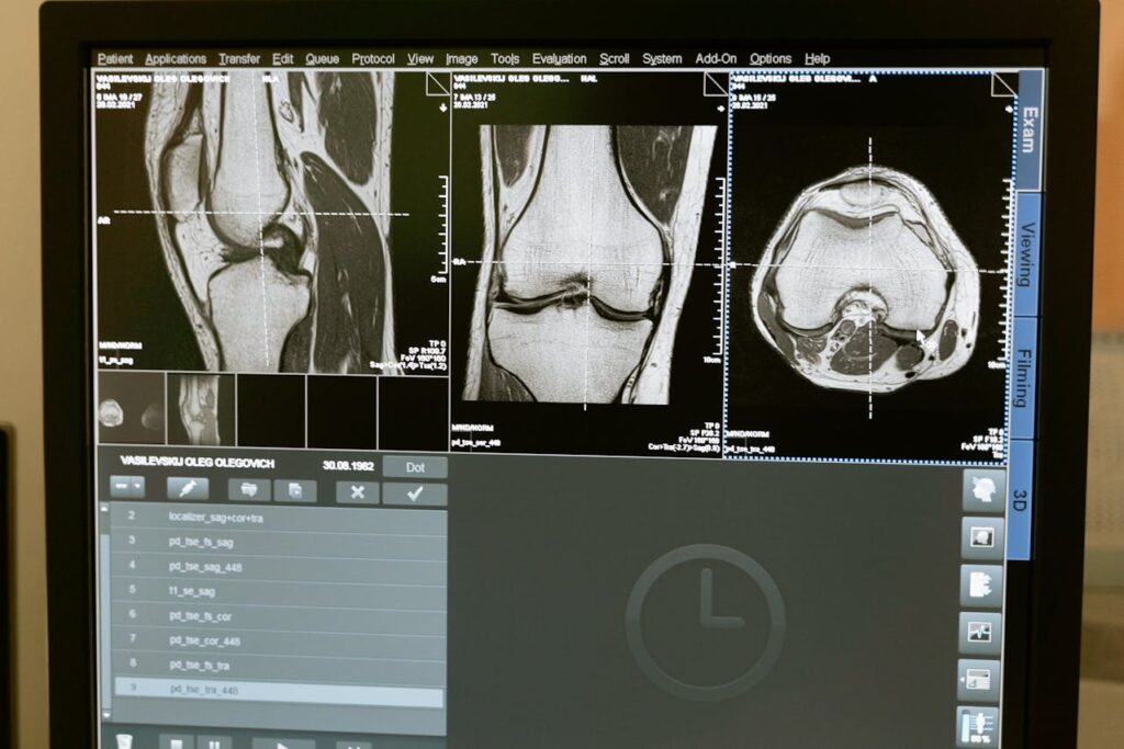 Innovations Transforming Orthopedic Surgery Pioneering a Brighter